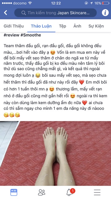 (Đủ bill+video mua hàng Nhật) Kem hỗ trợ thâm Smoothe nội địa Nhật Bản | BigBuy360 - bigbuy360.vn