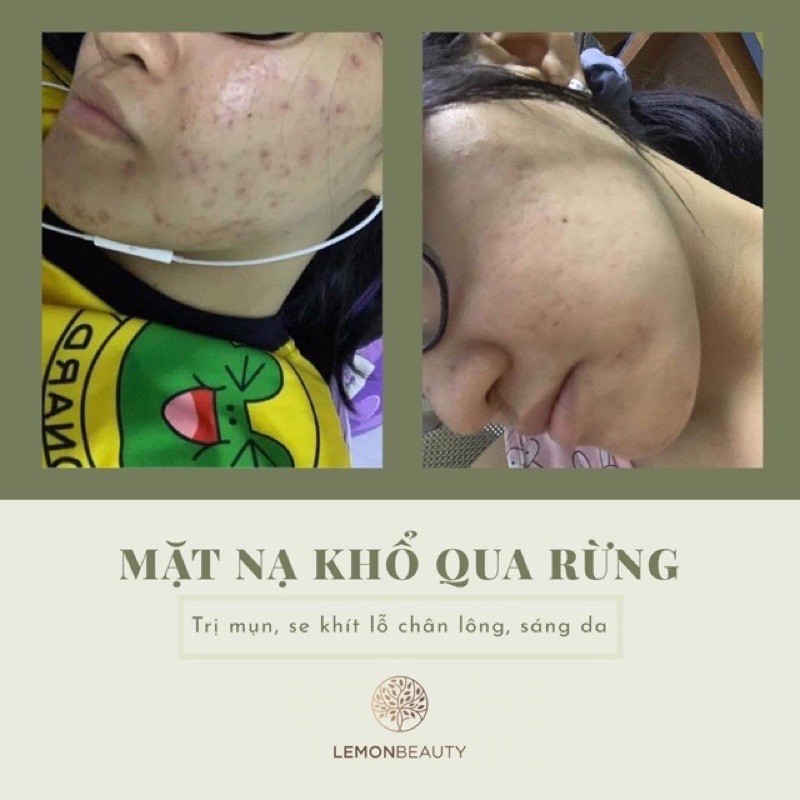 Mask Khổ Qua Rừng tặng cọ quét + băng đô tai mèo + cọ lông + thẻ tích điểm