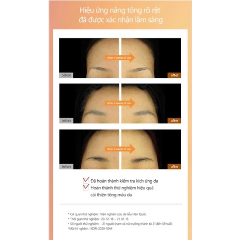 Serum siêu Cấp nước cho da Moisture Aqua Serum Oxygen