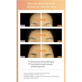Serum siêu Cấp nước cho da Moisture Aqua Serum Oxygen