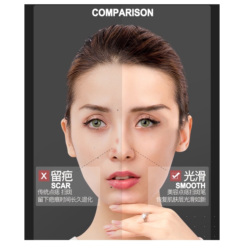 9 cấp độ LCD Mặt da Da vết thâm Xóa nốt ruồi Xóa hình xăm bằng Laser Plasma Máy Pen trên khuôn mặt Xóa tàn nhang Tag mụn trứng cá Xóa vết thâm Chăm sóc sắc đẹp
