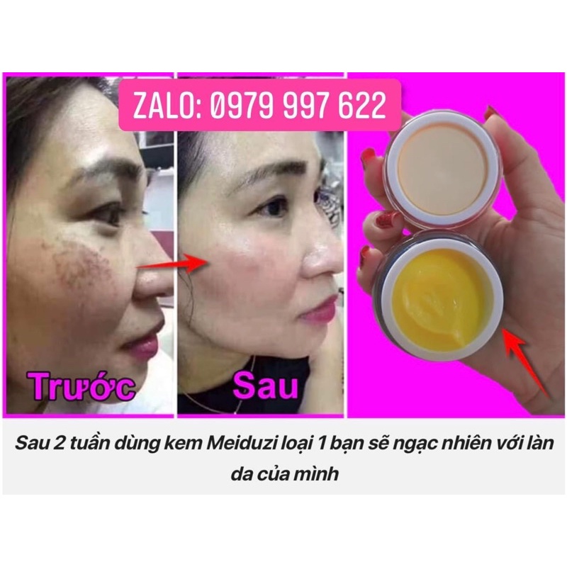 Combo 2 Kem Face Meiduzi Nhật và serum HD Phạm Điệp bộ dưỡng trắng ngày và đêm xoá mờ nám tàn nhang cực hiệu quả | BigBuy360 - bigbuy360.vn