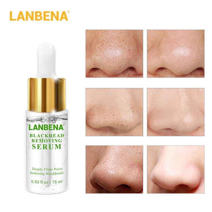 Tinh chất loại bỏ mụn đầu đen - se khít lỗ chân lông Lanbena BlackHead Removing Serum VG