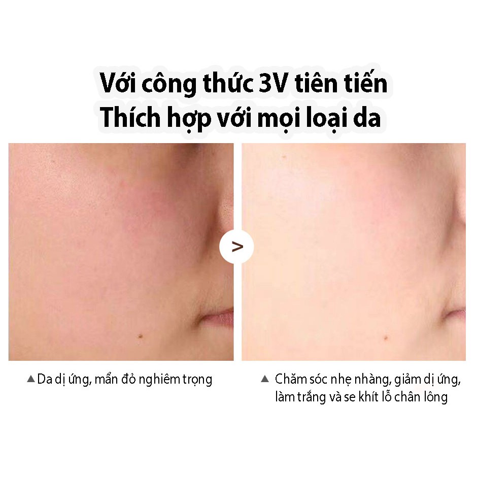 [HCM] Vibrant Glamour Kem Làm Trắng Da Retinol Dưỡng Ẩm Cấp Nước Chống Lão Hóa Loại Bỏ Nếp Nhăn Moisturizing Anti-aging