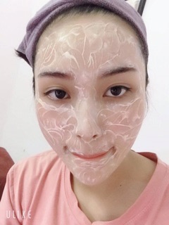 Cấy phấn Baby Mesowhite