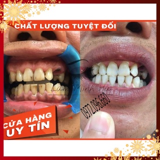 [FREESHIP 99K]Bộ tẩy trắng răng dr.white
