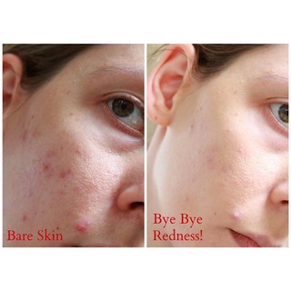 Lotion xẹp mụn Bye Bye Blemish Drying Lotion