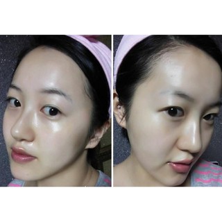 Mặt nạ tinh chất tổ yến Luvis