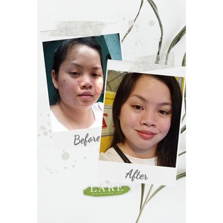 30ml serum Thanh Dược Lare