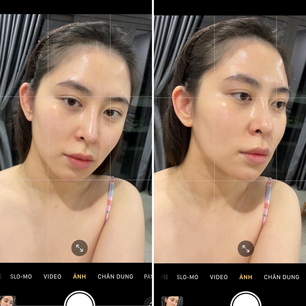 Kem dưỡng chống lão hóa, giảm nếp nhăn, giảm nám, tàn nhang Retinol Skin Brightener 0.25%, 0.5%, 1%