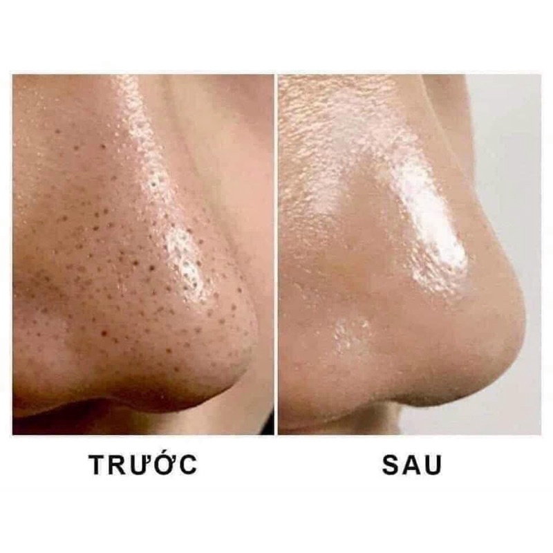 🌸 Dung Dịch Toner Tẫy tế bào chết Ố BÀ DI | BigBuy360 - bigbuy360.vn