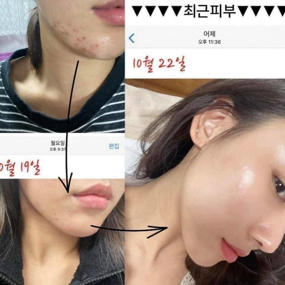 Mặt Nạ Yuejin B5 Repair Control EGF Mask