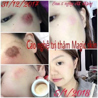 KEM NGỪA THÂM MAGIC SKIN