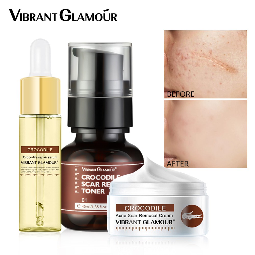Set 3 Món Serum + Toner + Kem VIBRANT GLAMOUR Dưỡng Ẩm Làm Trắng Hỗ Trợ Mờ Thâm Giảm Sẹo Và Vết Rạn Da | BigBuy360 - bigbuy360.vn