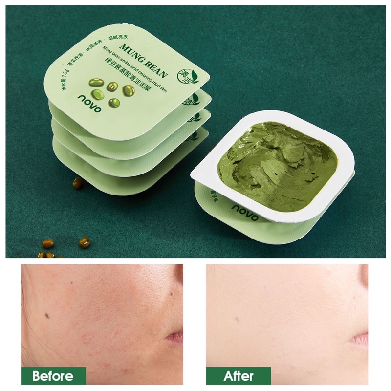 Mặt Nạ Dưỡng Ẩm Làm Trắng Da Kiểm Soát Dầu Phục Hồi Da Thu Nhỏ Lỗ Chân Lông Novo nội địa Trung | BigBuy360 - bigbuy360.vn