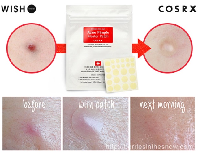 Miếng Dán Mụn Cosrx Acne Pimple Master Patch