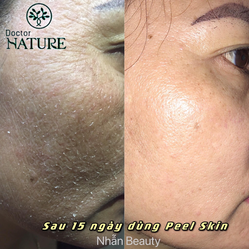 PEEL SKIN DOCTOR NATURE