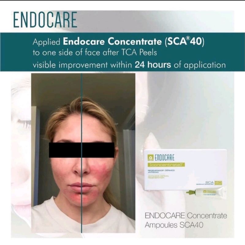 PEEL Da sinh Học tại nhà Neostrata PROCYSTEM RETINOL PEEL, thay da tại nhà Neostrata [ chính hãng ]