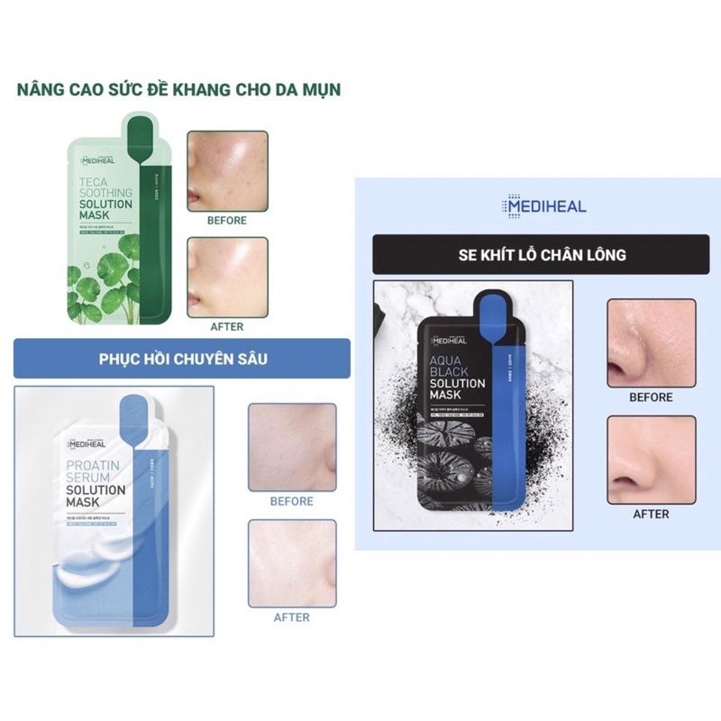 Mặt nạ giấy cấp ẩm, dưỡng trắng, làm dịu da, loại bỏ bã nhờn và cung cấp dưỡng chất cho da Mediheal Mask EX 25ml | WebRaoVat - webraovat.net.vn