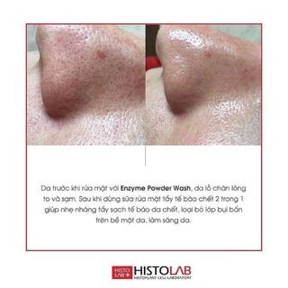 Bột Rửa Mặt enzyme Histolab 50GRAM