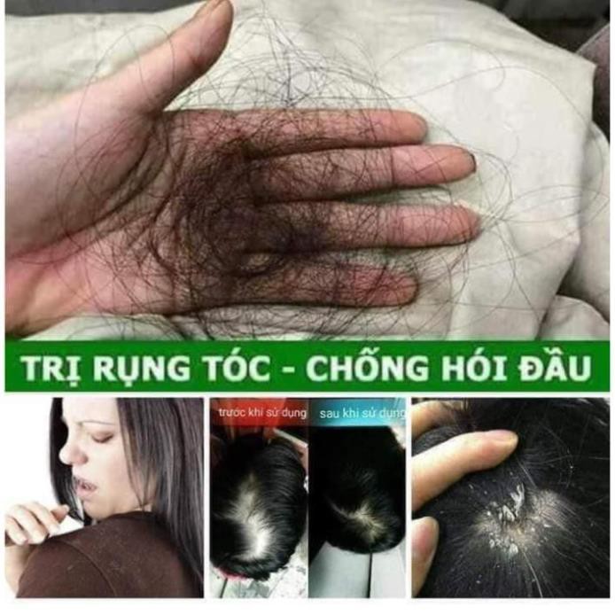 [ Chính hãng 100%] Dầu gội thảo dược Thanh Mộc Hương 350ml