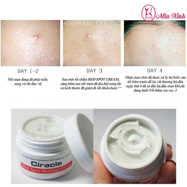 KEM NGỪA MỤN GIẢM THÂM [CIRACLE] Red Spot Cream