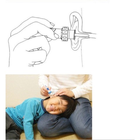 Máy hút ráy tai I EARS Nhật Bản Siêu Thông Minh Siêu Tiện Dụng Cho Gia Đình TL028
