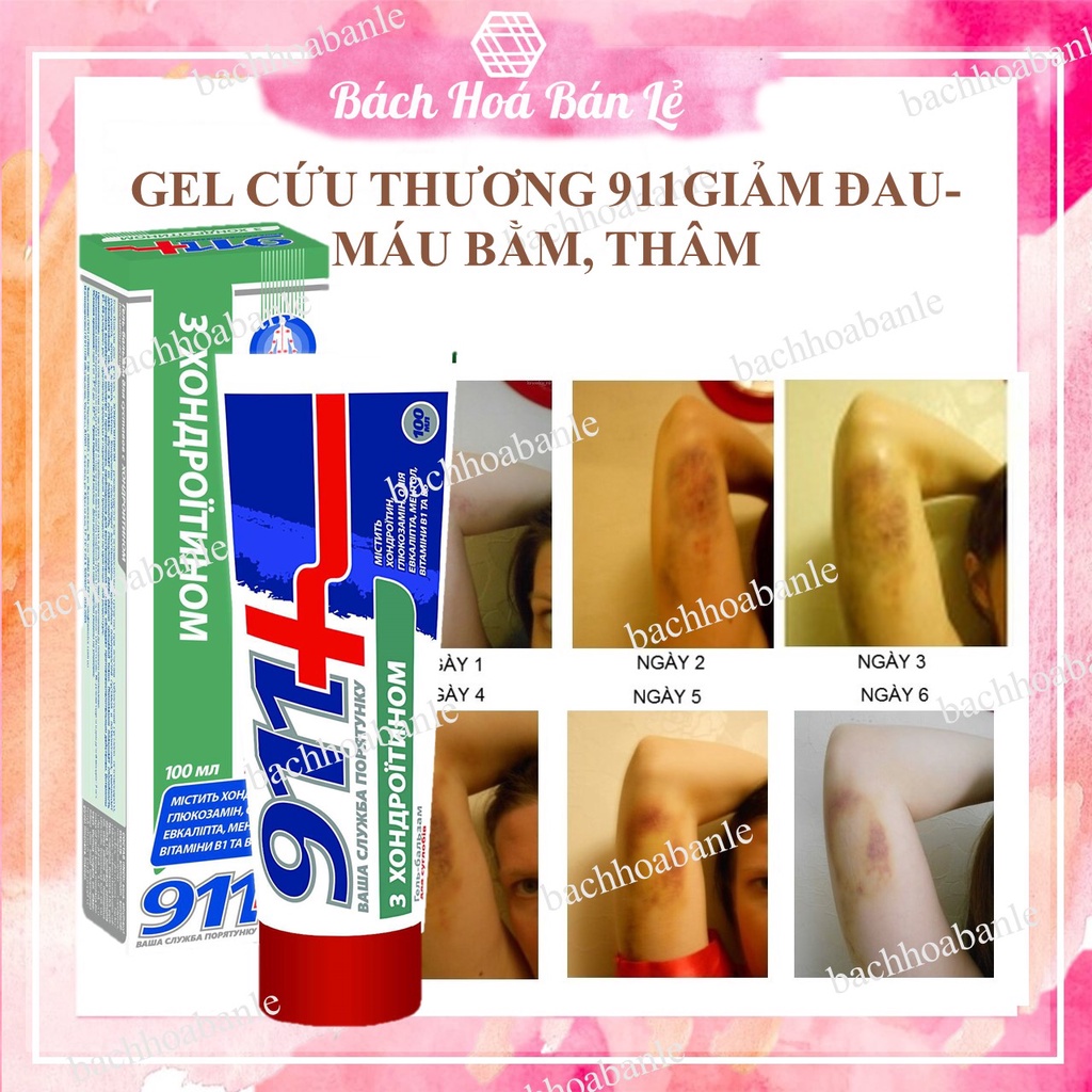 GEL CỨU THƯƠNG 911 GIẢM ĐAU-GIẢM MÁU BẰM, THÂM TÍM-GIẢM THÂM SAU MỤN-TRỊ VIÊM NANG LÔNG