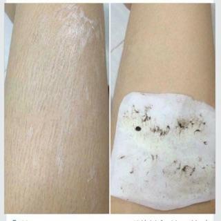 Triệt lông My Miu.