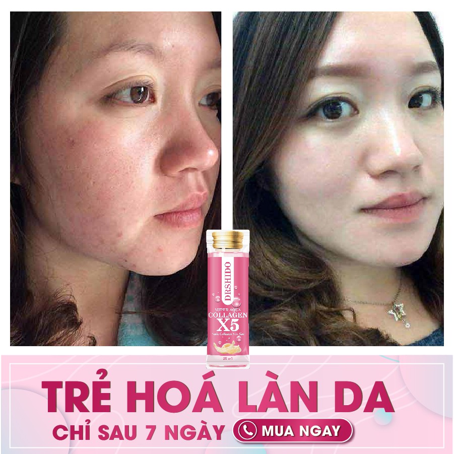 Supper aqua collagen X5 chính hãng - Nước collagen Yến Sào -  Loại 14 gói | BigBuy360 - bigbuy360.vn