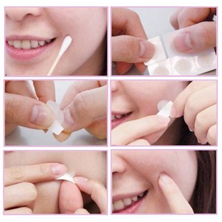 Miếng dán mụn some by mi spot patch