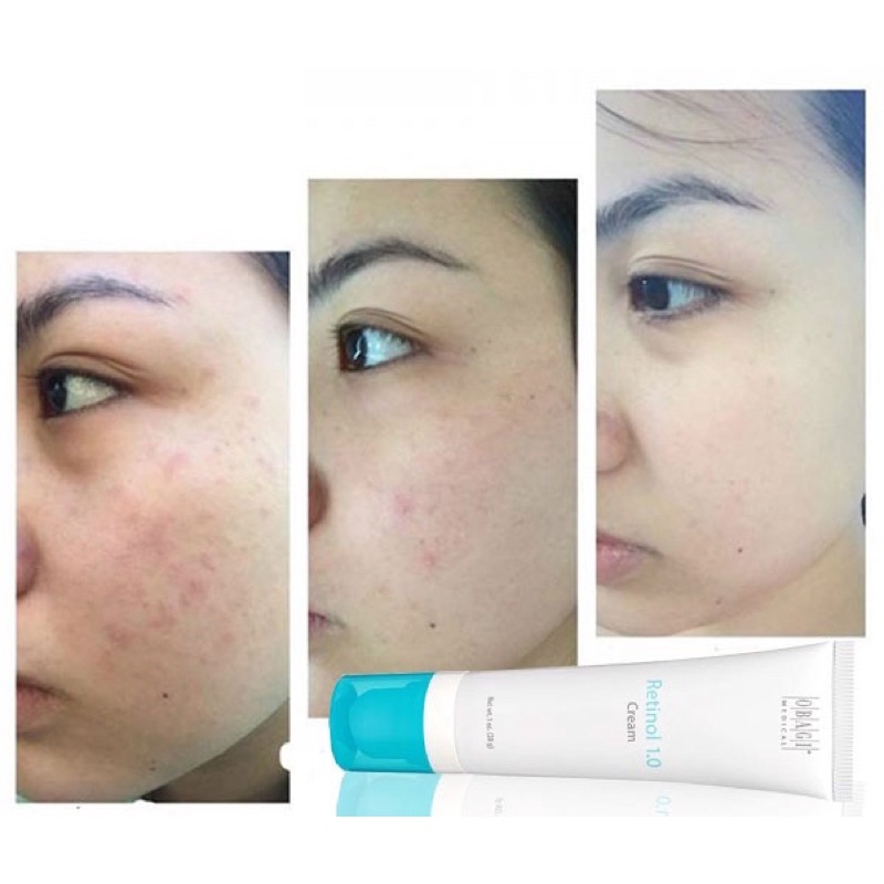 Kem trẻ hoá làn da Retinol Obagi 0.5 và Retinol 1.0 SeeMe Beauty SC-011