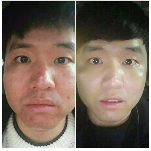 TINH CHẤT CĂNG BÓNG VOLUME TOX ORIGINAL PION-TECH