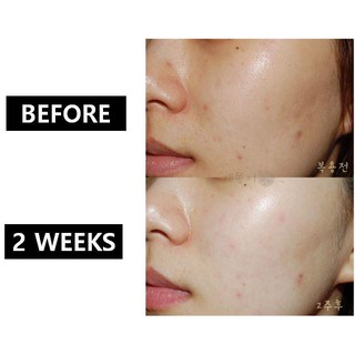 Nước uống #Innerb Glowshot Collagen 3000mg (12 chai)