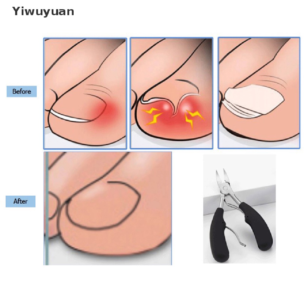 &lt; Yiwuyuan &gt; Bấm Móng Chân Chịu Được Sức Nặng Chính Xác