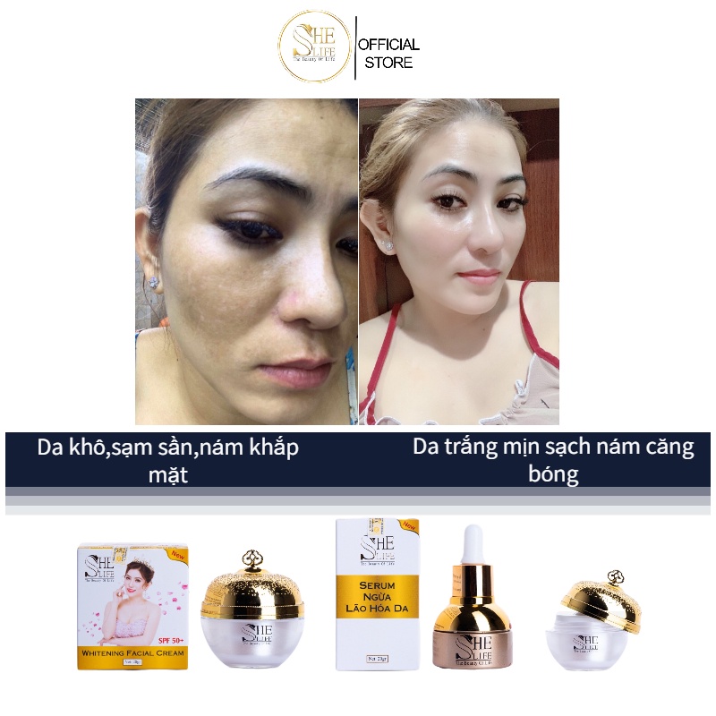 Kem Trắng Da Sạch Nám Tàn Nhang She Life Ban Ngày 20Gr và Ban Đêm 10Gr, Serum Dưỡng Da Cao Cấp 20ml