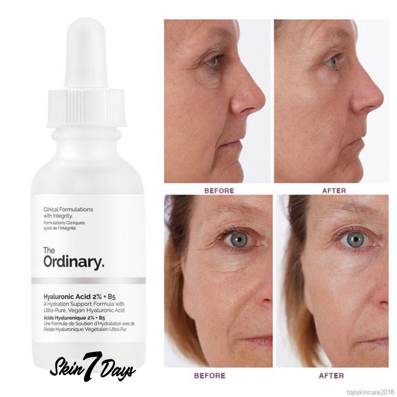 Tinh Chất Cấp Nước Tinh Chất The Ordinary Hyaluronic Acid 2% + B5 Serum 30ml