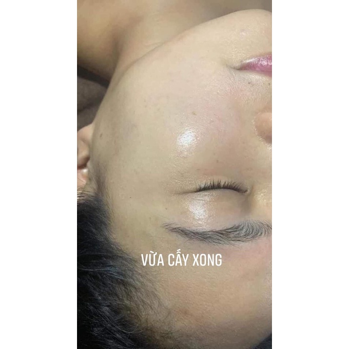 CẤY TRẮNG LỤA NANO COLLAGEN