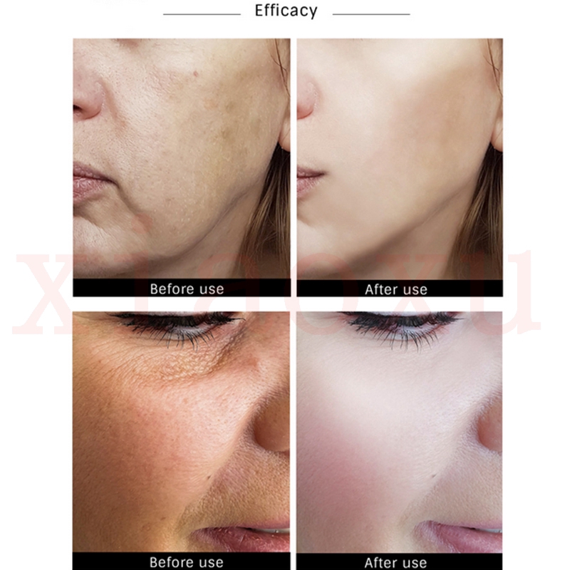 [Hàng mới về] Serum dưỡng da tinh chất Vitamin C hạt nho làm đẹp da hiệu quả | BigBuy360 - bigbuy360.vn