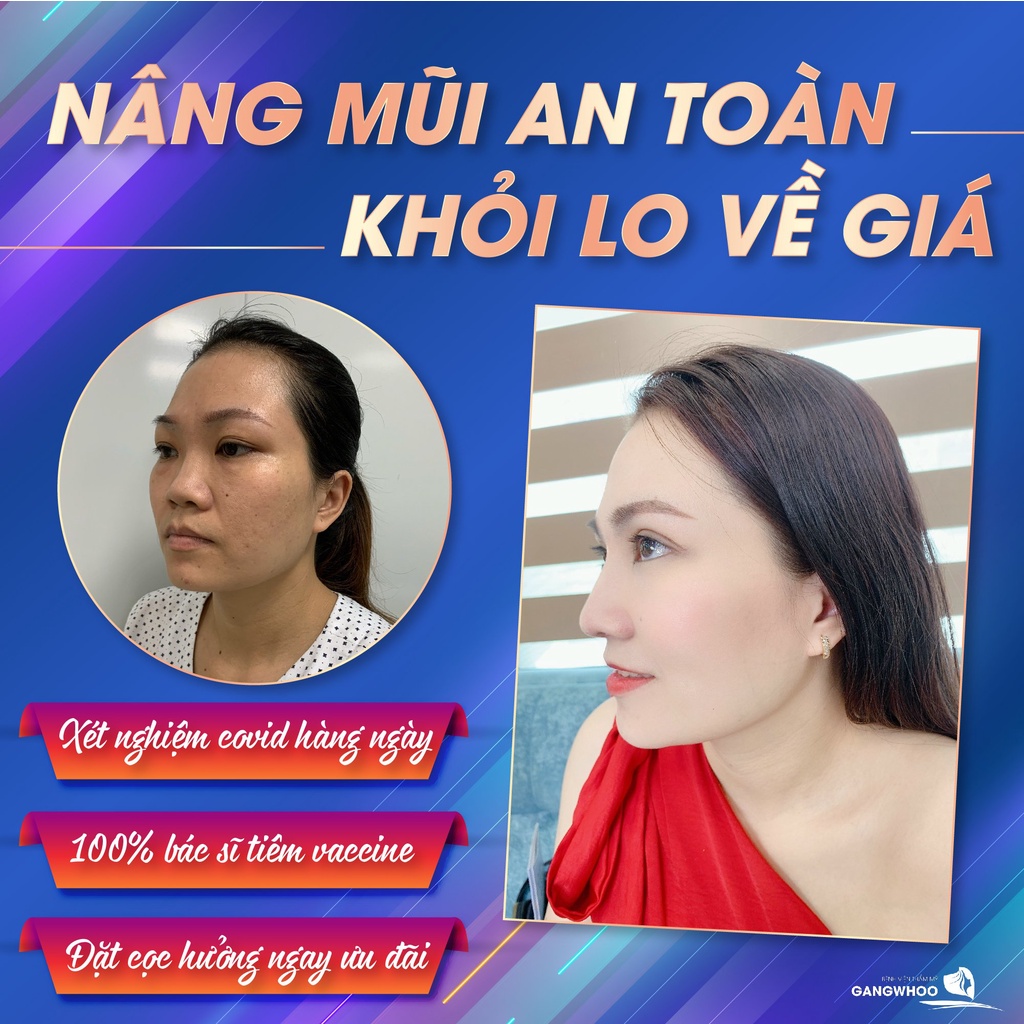 Dịch vụ nâng mũi Hàn Quốc tại Gangwhoo