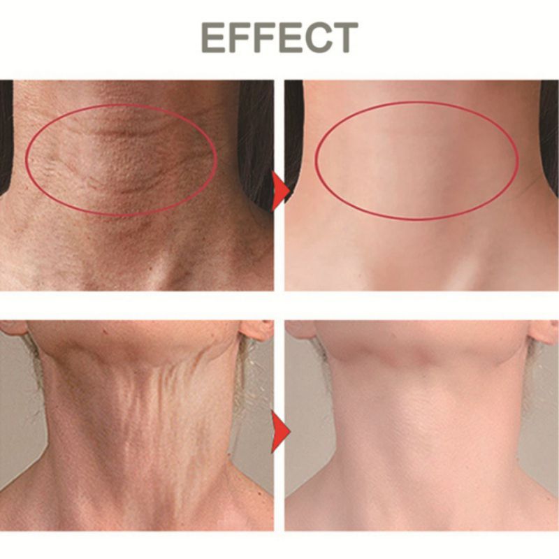 Kem Hyaluronic acid Dưỡng Ẩm Săn Chắc Vùng Da Cổ