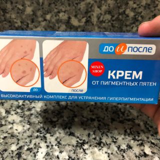 Kem đồi mồi tay Kpem Nga