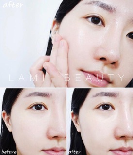 Tinh Chất AMPLEN Peptide Shot Ampoule Coreana