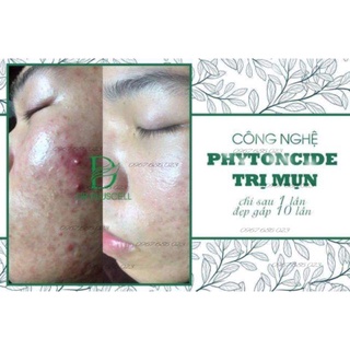 Hộp tế bào gốc mụn Dr pluscell ( CAM KẾT HÀNG CHÍNH HÃNG )