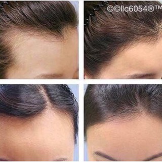 SERUM MỌC TÓC KAMINOMOTO