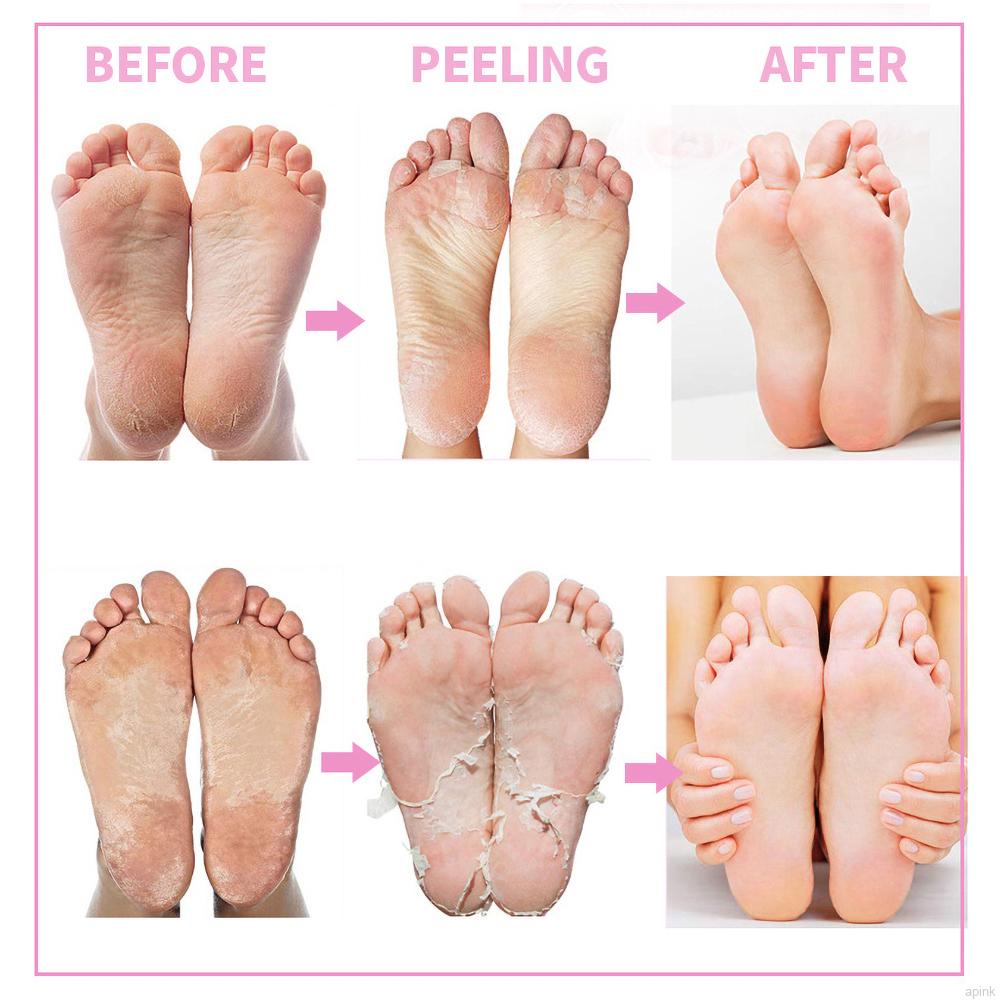 Mặt Nạ Lột Da Chân Tẩy Tế Bào Chết Dưỡng Ẩm Chăm Sóc Da Bàn Chân