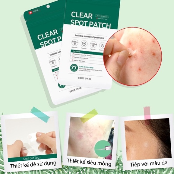 Miếng Dán Mụn Some By Mi Clear Spot Patch - Elbi Beauty Cosmetics &amp; Skincare