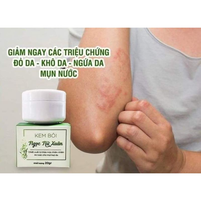 Kem bôi ngứa viêm da hiệu quả ngọc nữ xuân 20g