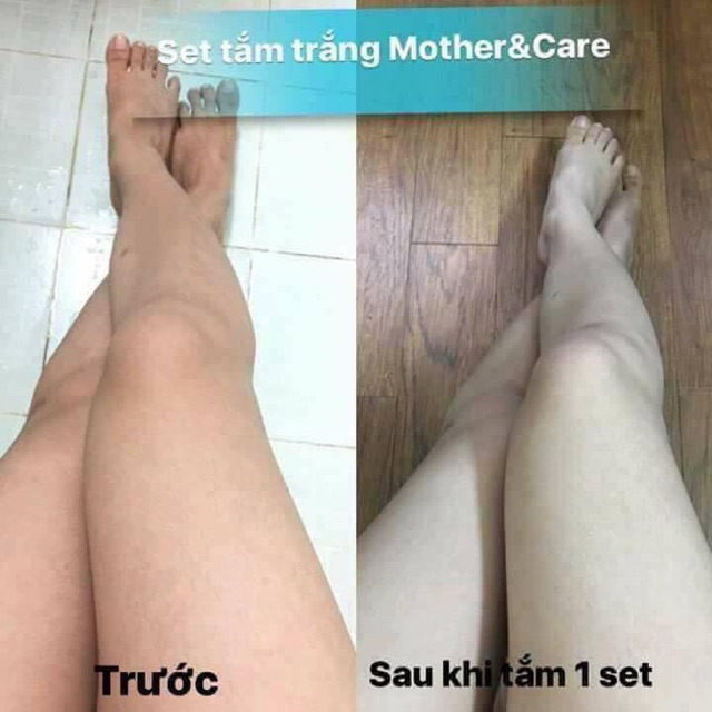 Sét Tắm Trắng Body Mother & Care