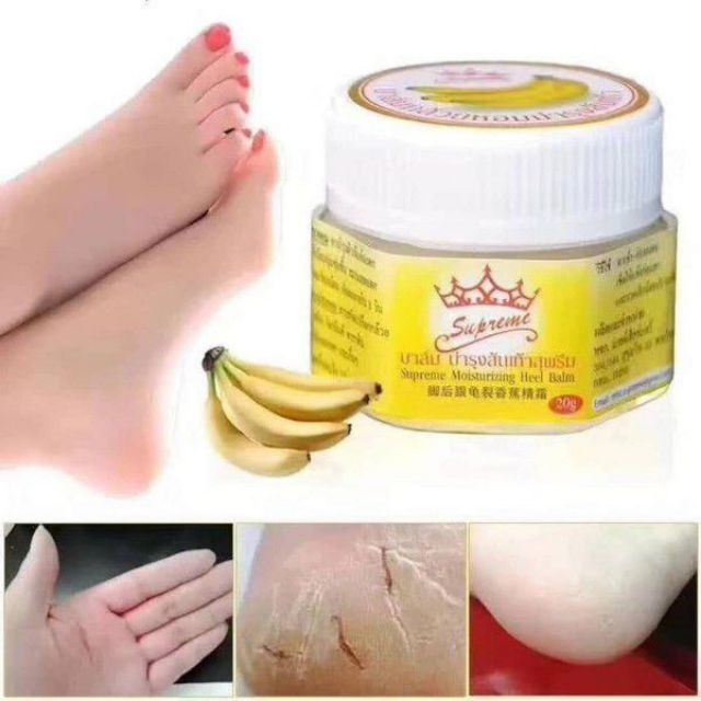 Kem chuối bôi nứt gót chân | BigBuy360 - bigbuy360.vn